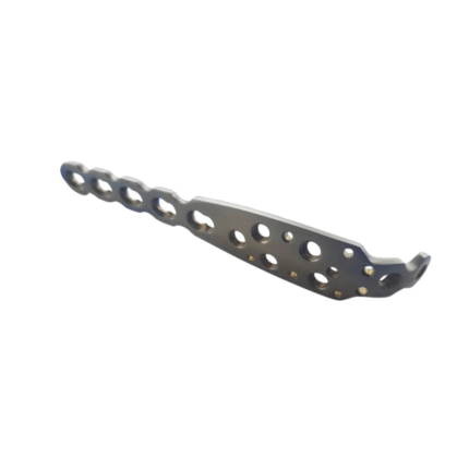 Locking Olecranon Plates (4-10 Holes) L&R with 3.5mm Screws, Titanium Grade 5 (126 Pieces)