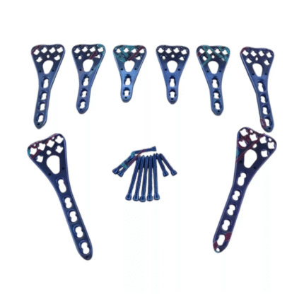 Surgical Plate & Locking Screw Set – 2.7mm, L/R, 2–4 Holes, 50 Pieces