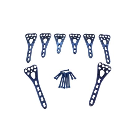 Distal Radius Volar Locking Plates (2–5 Holes, L/R) with Screws – 86 Pcs Titanium Set